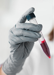 Imagem de exame de sangue